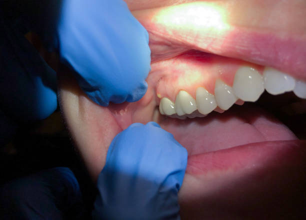 Best Cracked Tooth Emergency Dentist  in Atoka, NM